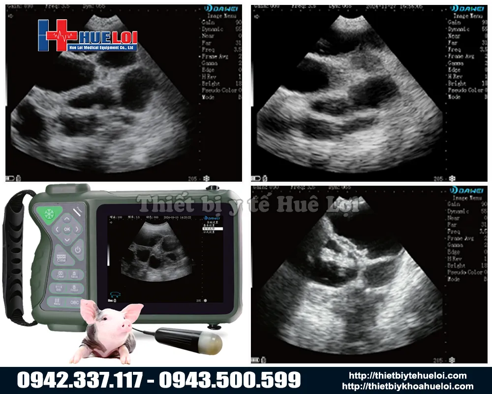 Máy siêu âm chẩn đoán thai cho lợn nái di động