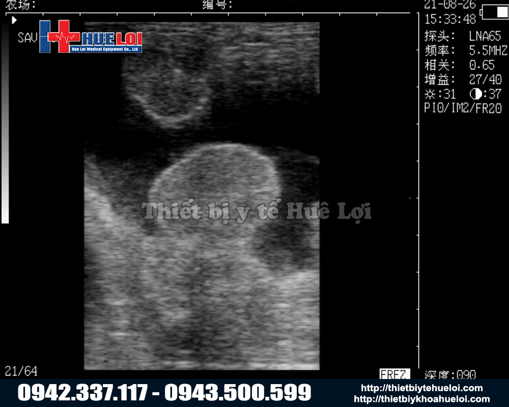 Máy siêu âm thú y 2D giá tốt