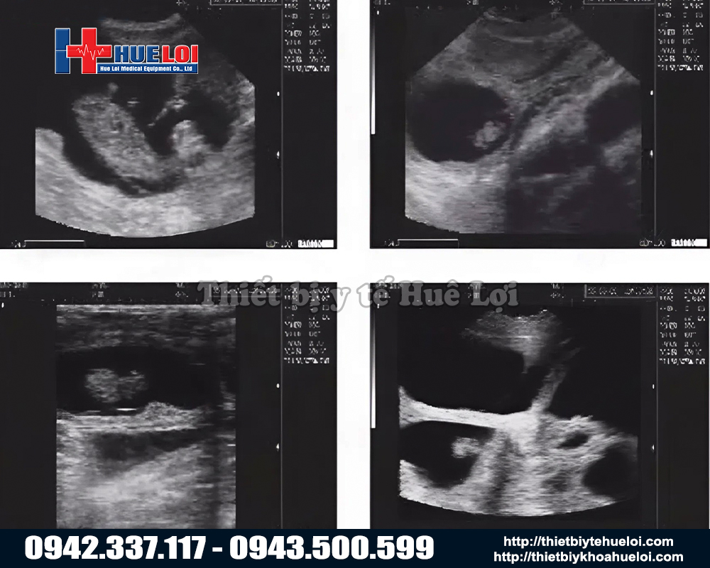 Hình ảnh siêu âm thú y rõ nét với máy siêu âm heo trang trại